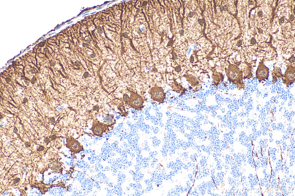 Immunohistochemistry (IHC) staining of mouse cerebellum tissue using Parvalbumin Polyclonal antibody (29312-1-AP)