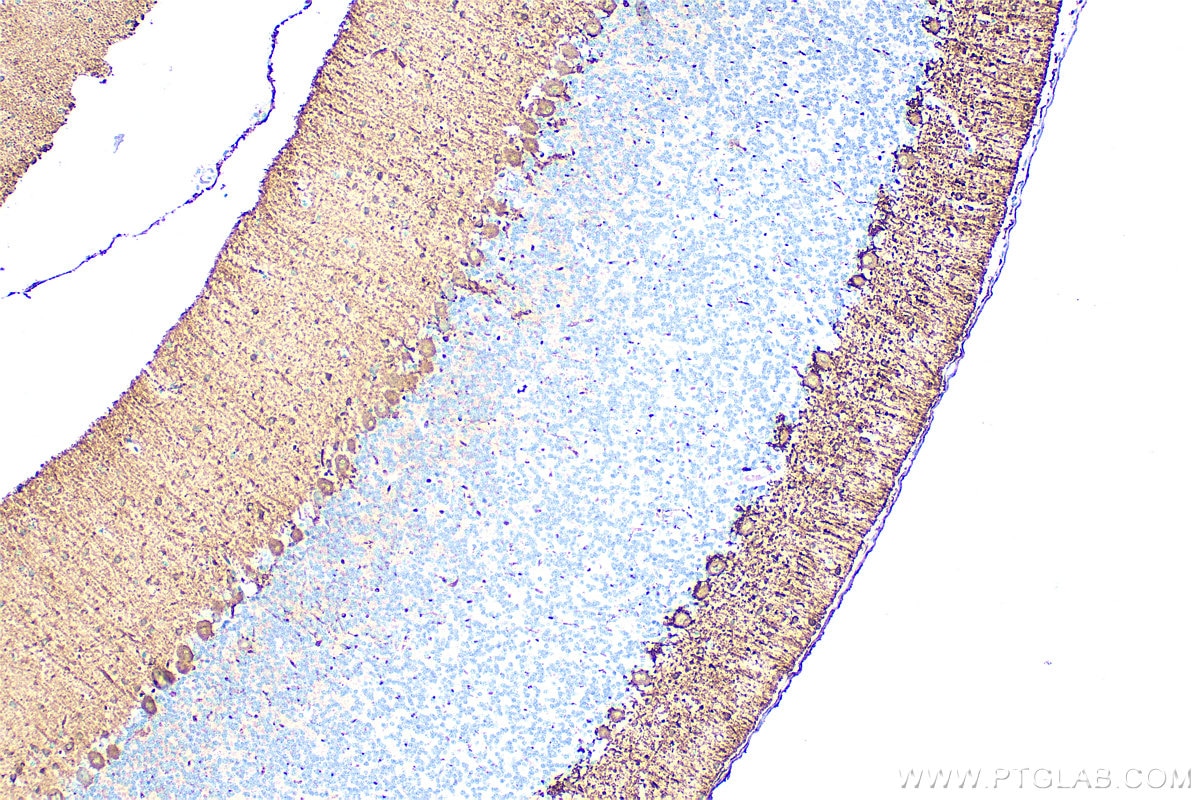 Immunohistochemistry (IHC) staining of rat cerebellum tissue using Parvalbumin Polyclonal antibody (29312-1-AP)
