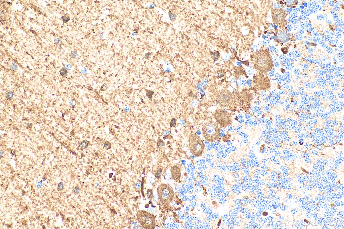 Immunohistochemistry (IHC) staining of rat cerebellum tissue using Parvalbumin Polyclonal antibody (29312-1-AP)