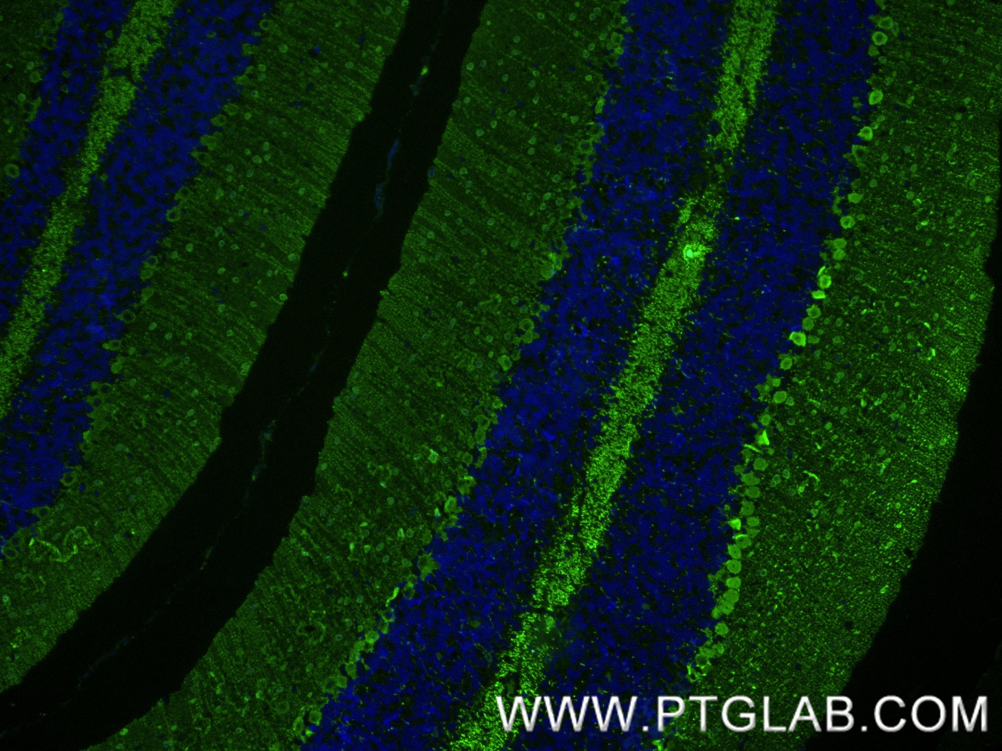 Immunofluorescence (IF) / fluorescent staining of mouse cerebellum tissue using Parvalbumin Recombinant antibody (85819-4-RR)