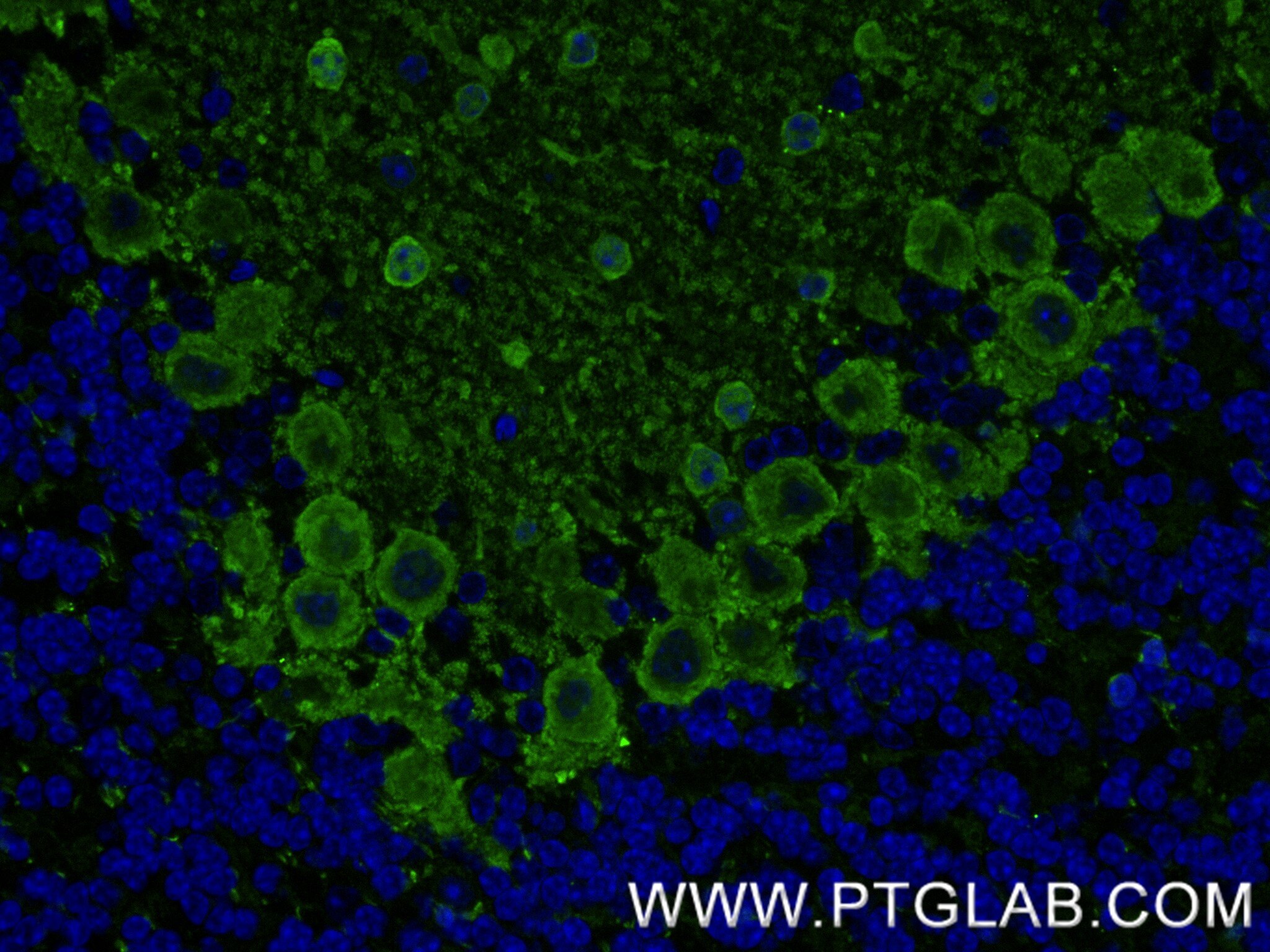 Immunofluorescence (IF) / fluorescent staining of mouse cerebellum tissue using Parvalbumin Recombinant antibody (85819-4-RR)