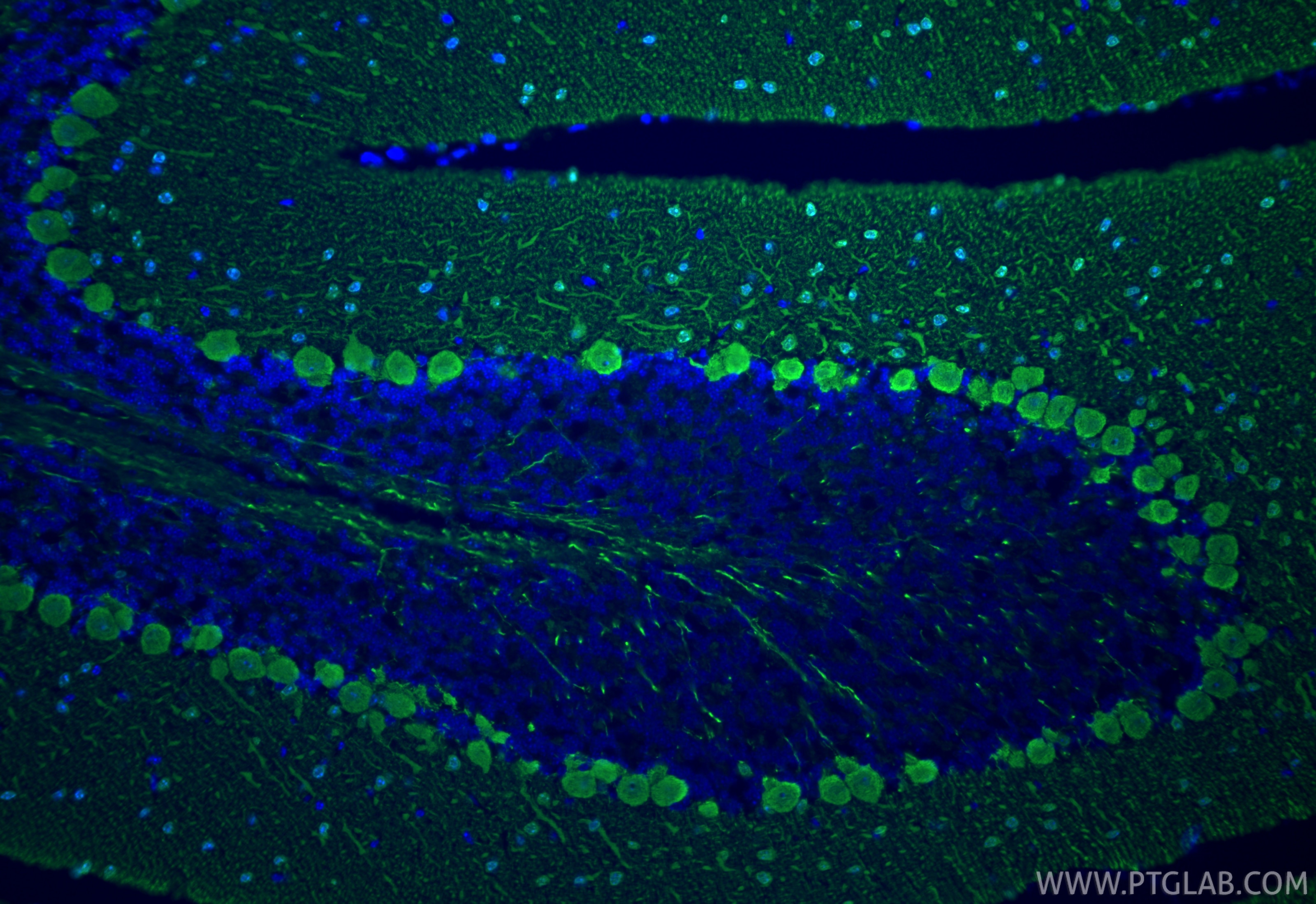 Immunofluorescent analysis of (4% PFA) fixed paraffin-embedded mouse cerebellum tissue using Parvalbumin antibody (85819-4-RR, Clone: 250158B6 ) at dilution of 1:400 and CoraLite®488-Conjugated Goat Anti-Rabbit IgG(H+L) (SA00013-2). Heat mediated antigen retrieval with Tris-EDTA buffer (pH 9.0). Immunofluorescence (IF) / fluorescent staining of mouse cerebellum tissue using Parvalbumin Recombinant monoclonal antibody (85819-4-RR)