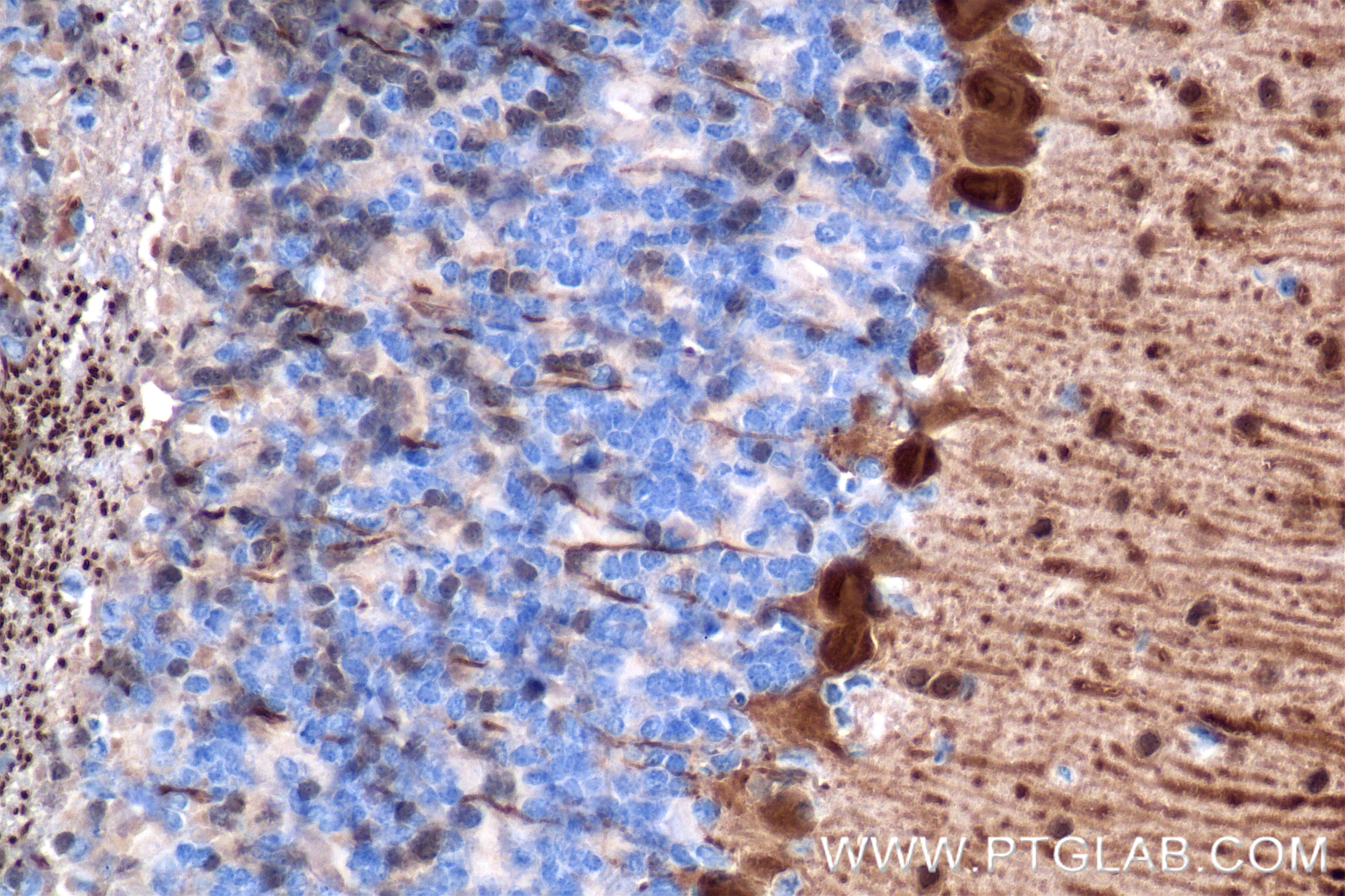 Immunohistochemistry (IHC) staining of mouse cerebellum tissue using Parvalbumin Recombinant antibody (85819-4-RR)