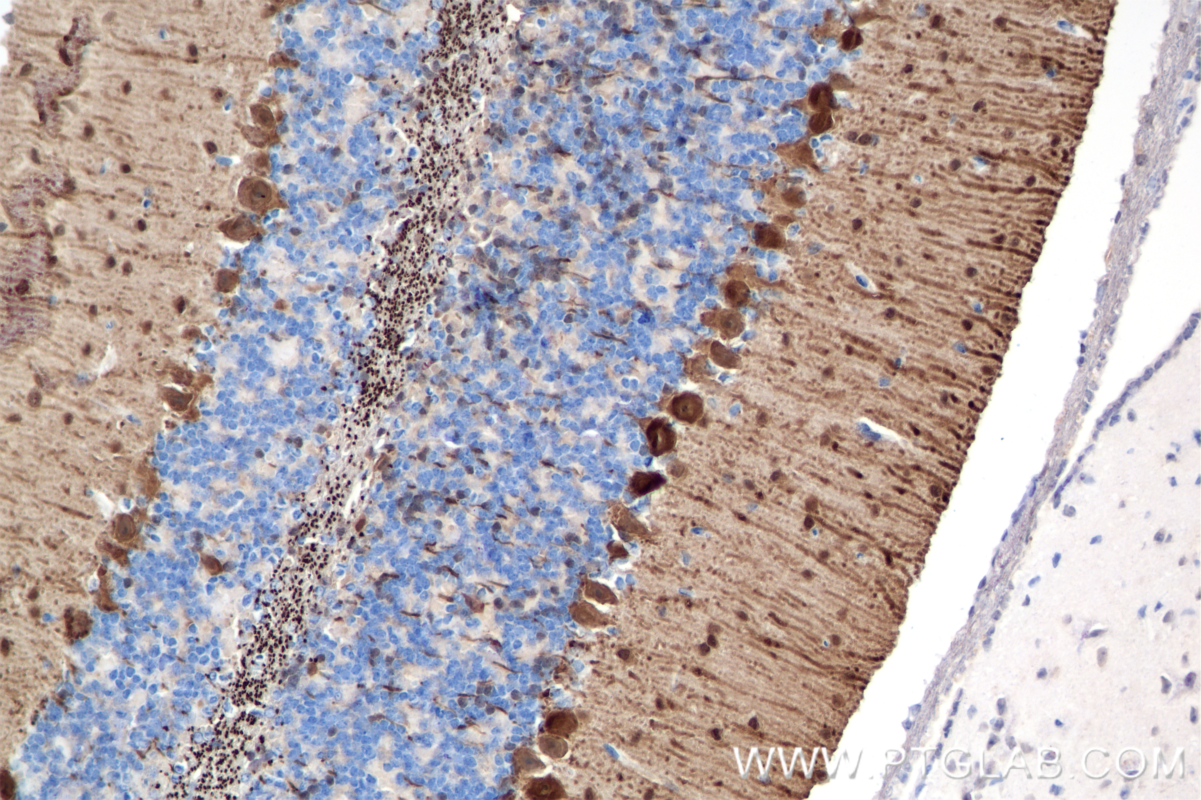 Immunohistochemistry (IHC) staining of mouse cerebellum tissue using Parvalbumin Recombinant antibody (85819-4-RR)