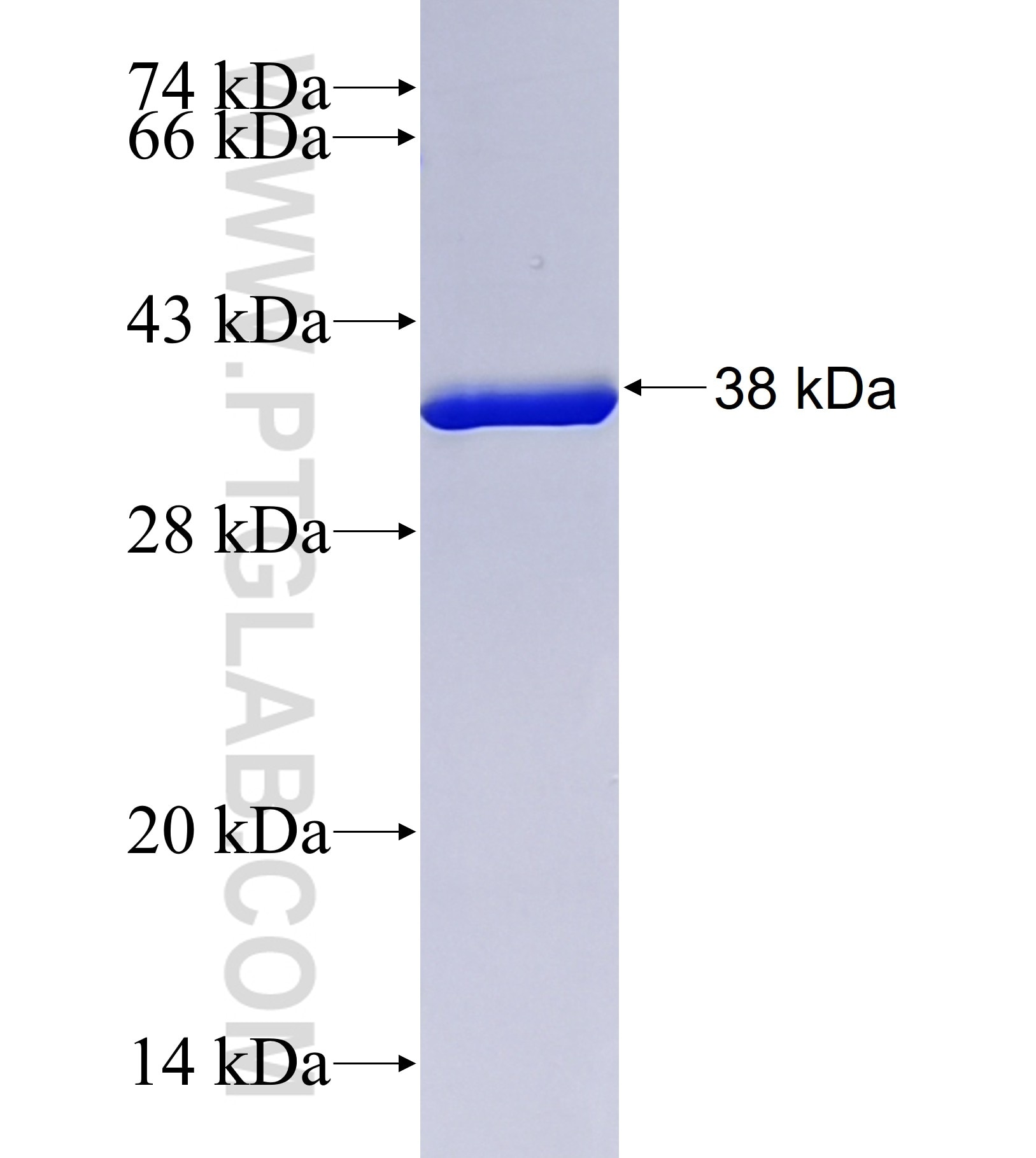 Parvalbumin alpha fusion protein Ag42021 SDS-PAGE Parvalbumin alpha fusion protein Ag42021 SDS-PAGE
