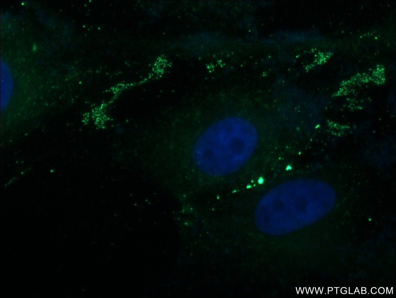 IF Staining of MDCK using 22172-1-AP