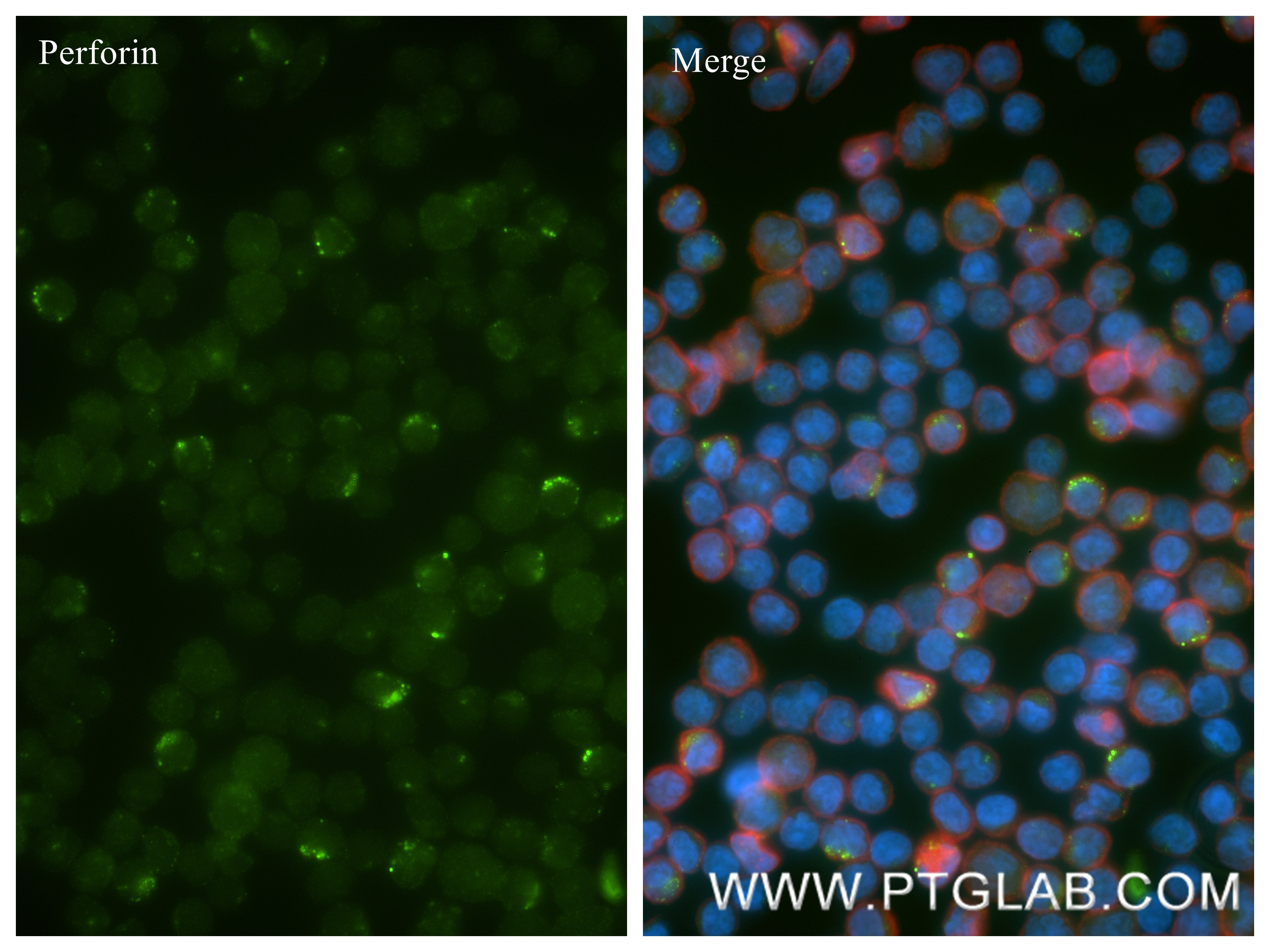 IF Staining of Human PBMC using 83977-1-RR Immunofluorescence (IF) / fluorescent staining of Human PBMC using Perforin Recombinant monoclonal antibody (83977-1-RR)