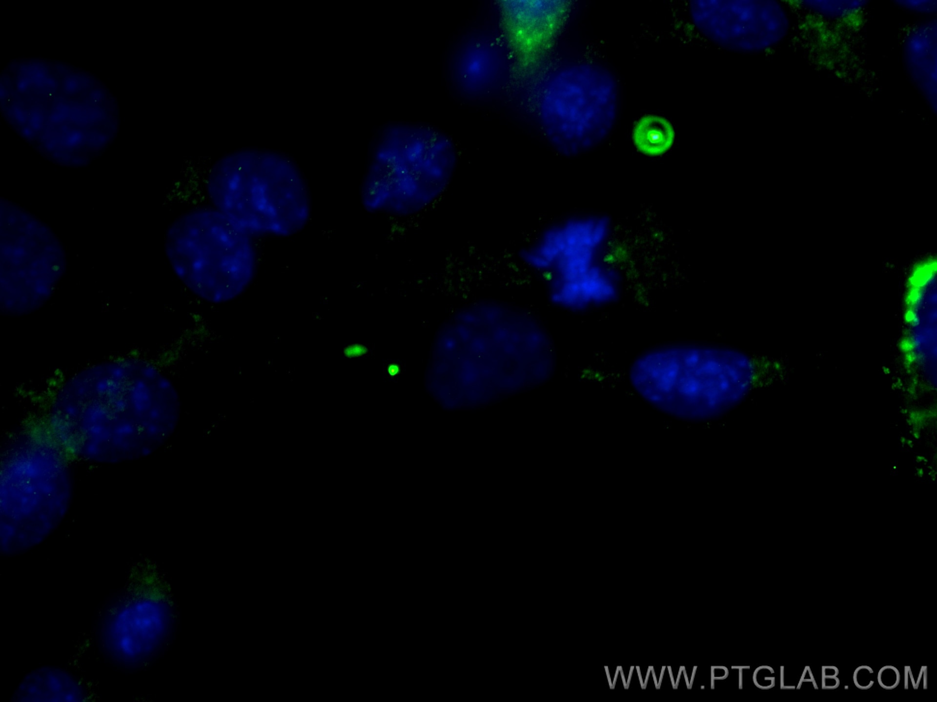 Immunofluorescence (IF) / fluorescent staining of C2C12 cells using Pericentrin Polyclonal antibody (22271-1-AP)