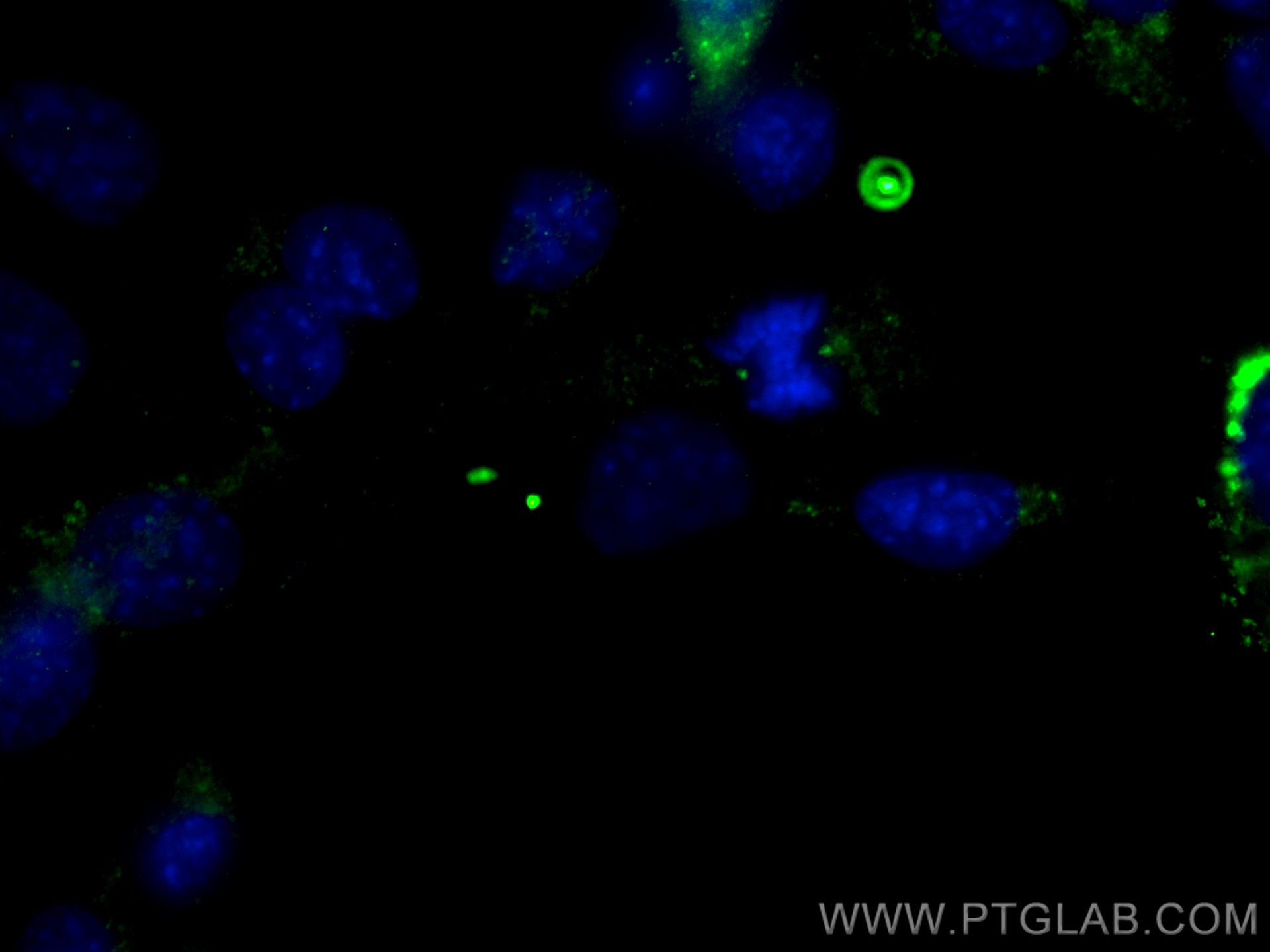 Pericentrin