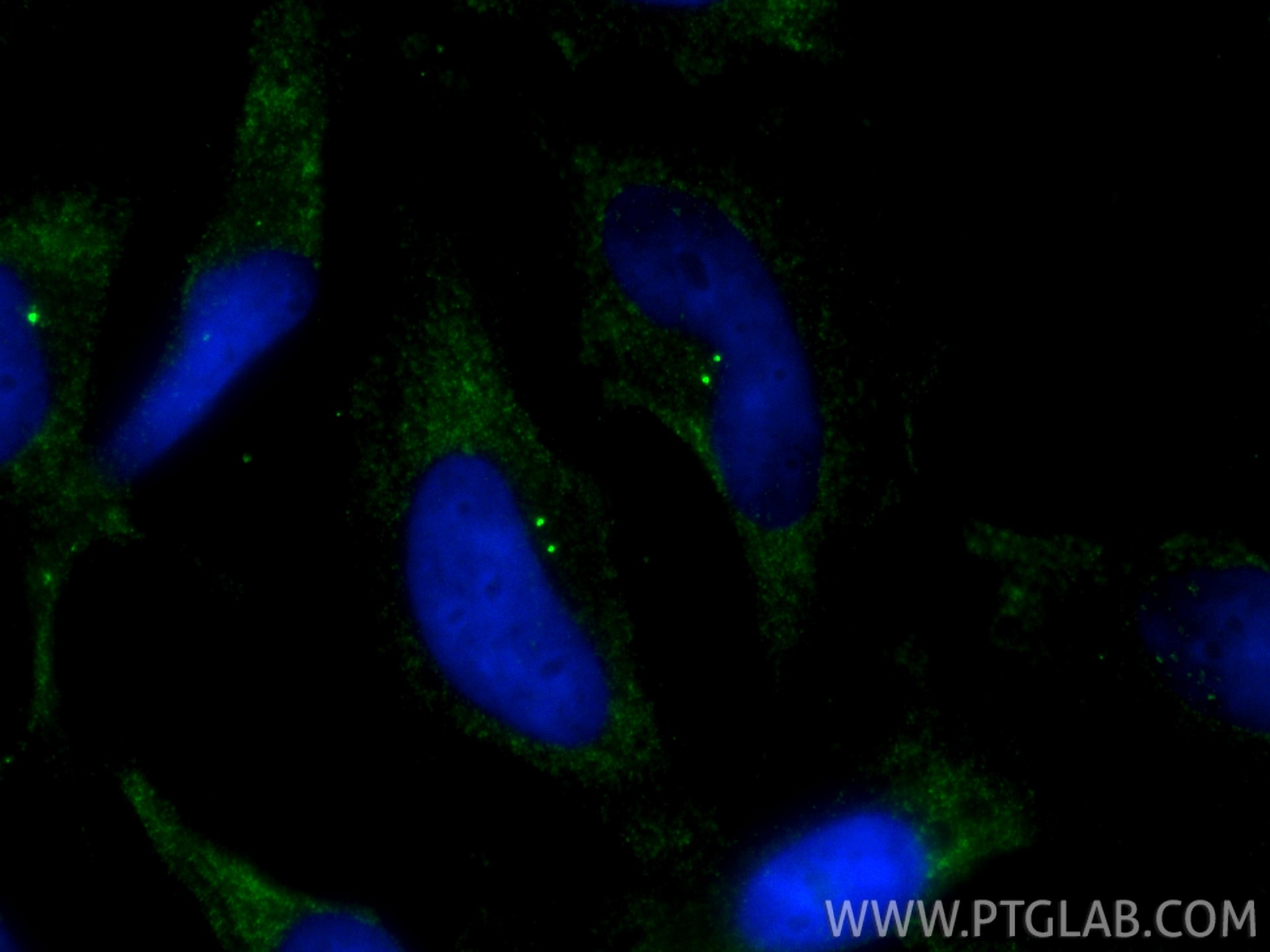 Immunofluorescence (IF) / fluorescent staining of HeLa cells using Pericentrin Monoclonal antibody (60919-2-Ig)