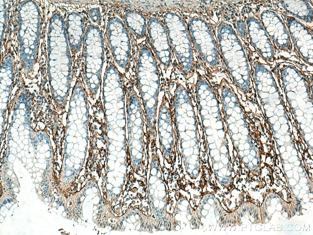 Immunohistochemistry (IHC) staining of human colon tissue using Periostin Polyclonal antibody (27794-1-AP)