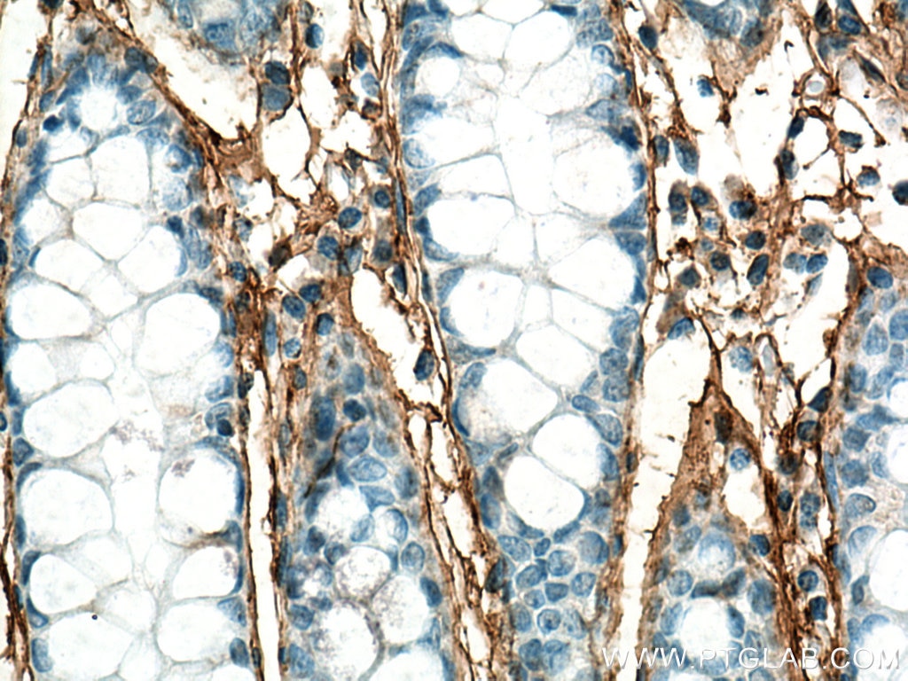Immunohistochemistry (IHC) staining of human colon tissue using Periostin Polyclonal antibody (27794-1-AP)