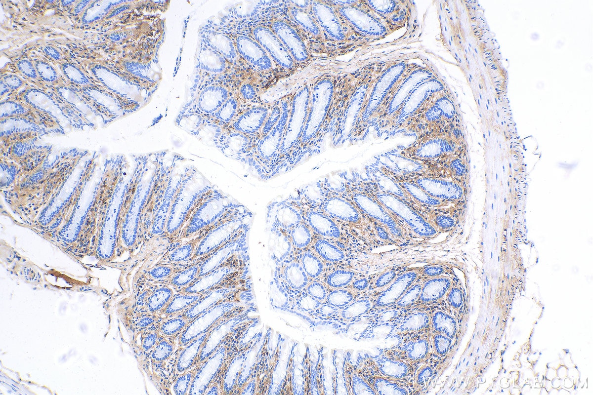 IHC staining of mouse colon using 27794-1-AP Immunohistochemistry (IHC) staining of mouse colon tissue using Periostin Polyclonal antibody (27794-1-AP)