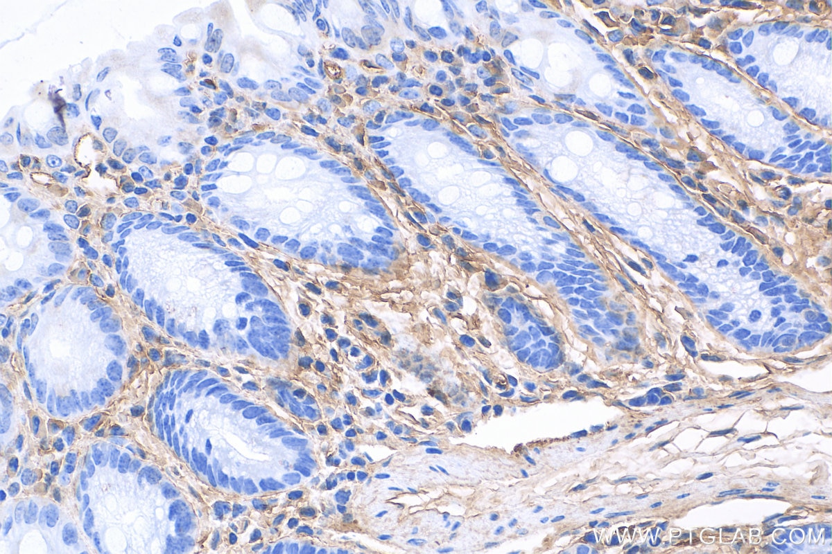 IHC staining of mouse colon using 27794-1-AP Immunohistochemistry (IHC) staining of mouse colon tissue using Periostin Polyclonal antibody (27794-1-AP)