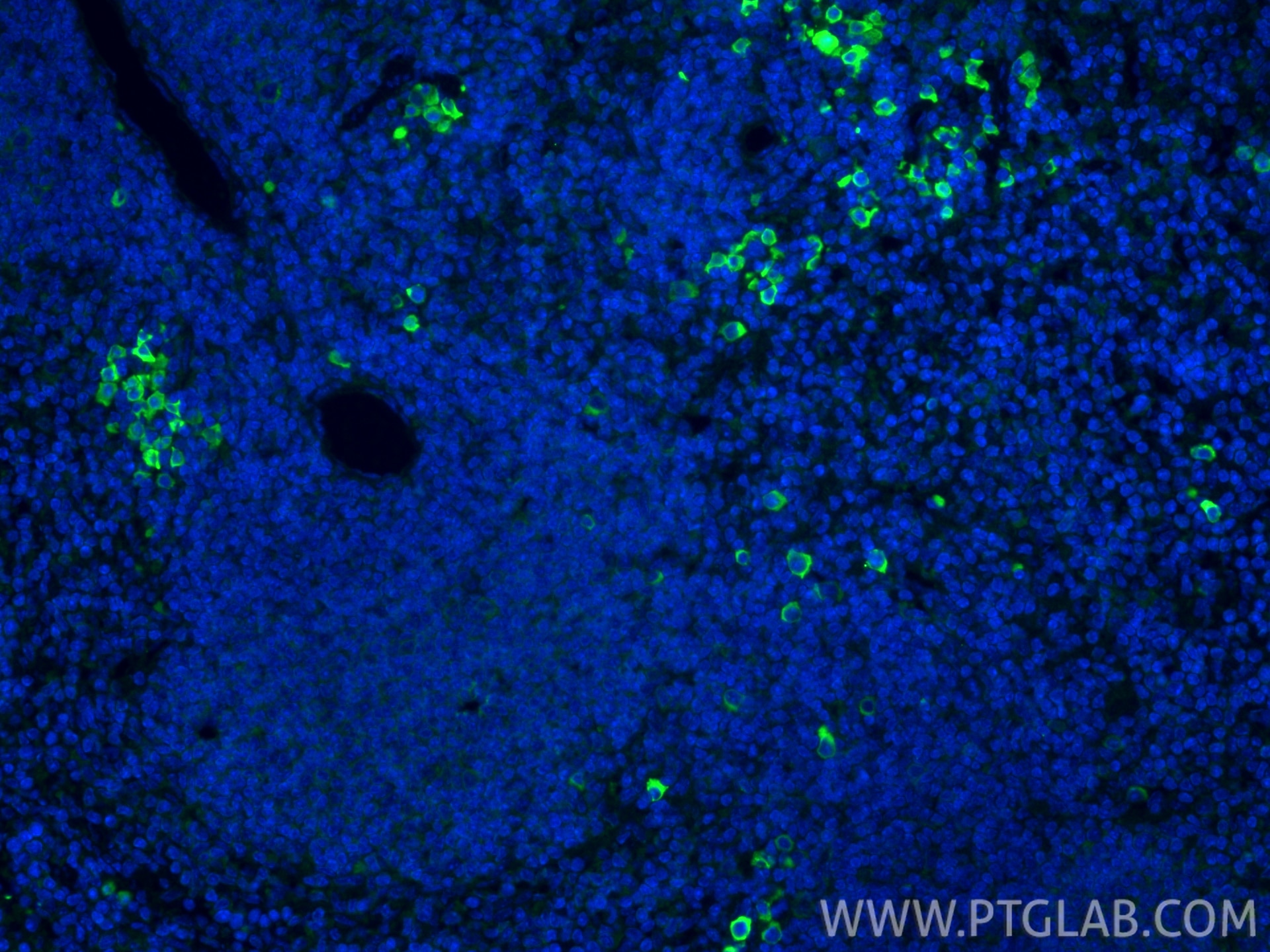 IF Staining of mouse spleen using 66491-1-Ig Immunofluorescence (IF) / fluorescent staining of mouse spleen tissue using Periostin Monoclonal antibody (66491-1-Ig)