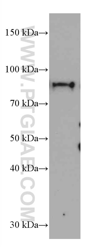 Western Blot (WB) analysis of Neuro-2a cells using Periostin Monoclonal antibody (66491-1-Ig)