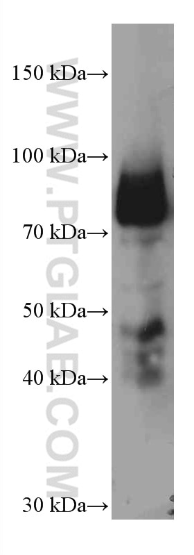 Western Blot (WB) analysis of human placenta tissue using Periostin Monoclonal antibody (66491-1-Ig)