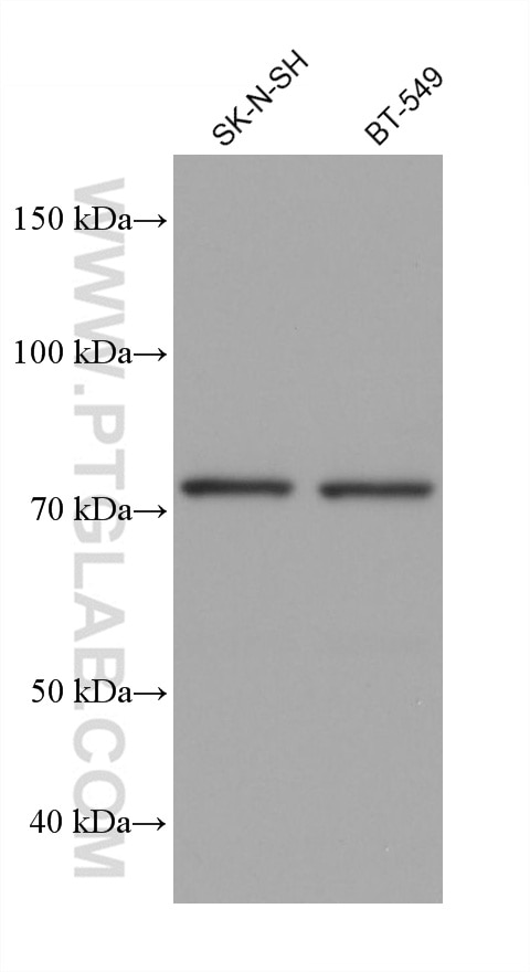 Western Blot (WB) analysis of various lysates using Periostin Monoclonal antibody (66491-1-Ig)