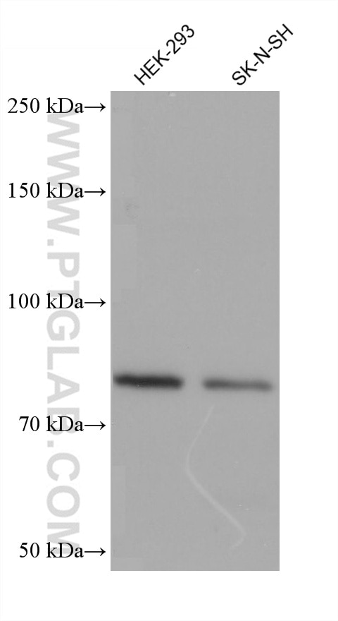 Western Blot (WB) analysis of various lysates using Periostin Monoclonal antibody (66491-1-Ig)