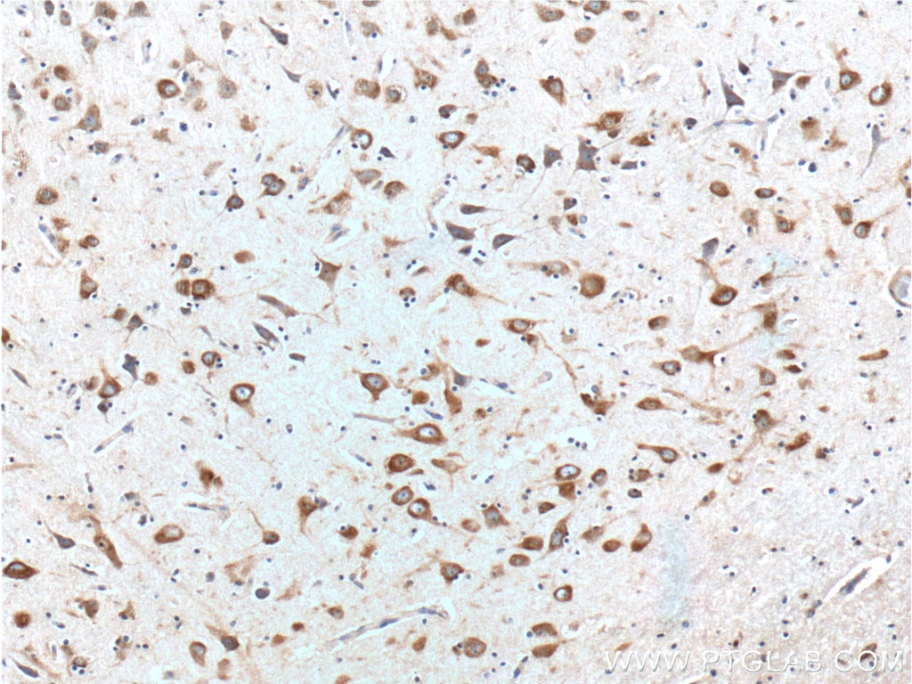 Immunohistochemistry (IHC) staining of human brain tissue using Peripherin Monoclonal antibody (66317-1-Ig)