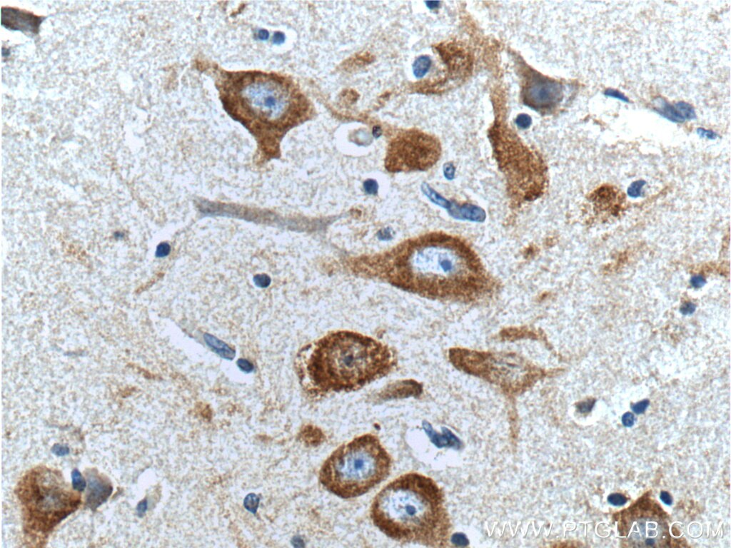 Immunohistochemistry (IHC) staining of human brain tissue using Peripherin Monoclonal antibody (66317-1-Ig)