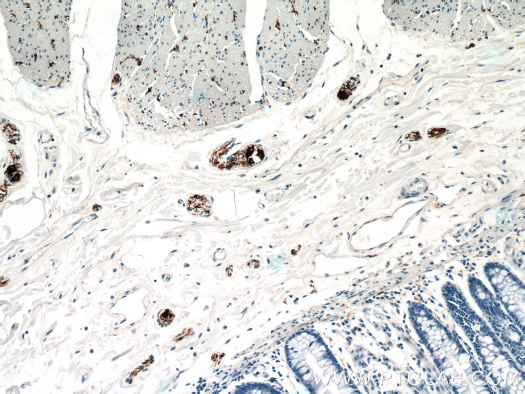 Immunohistochemistry (IHC) staining of human colon tissue using Peripherin Monoclonal antibody (66317-1-Ig)