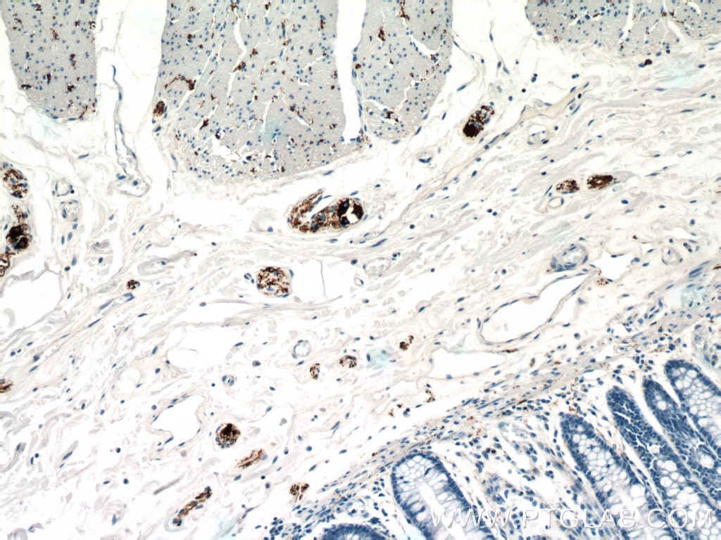 IHC staining of human colon using 66317-1-Ig