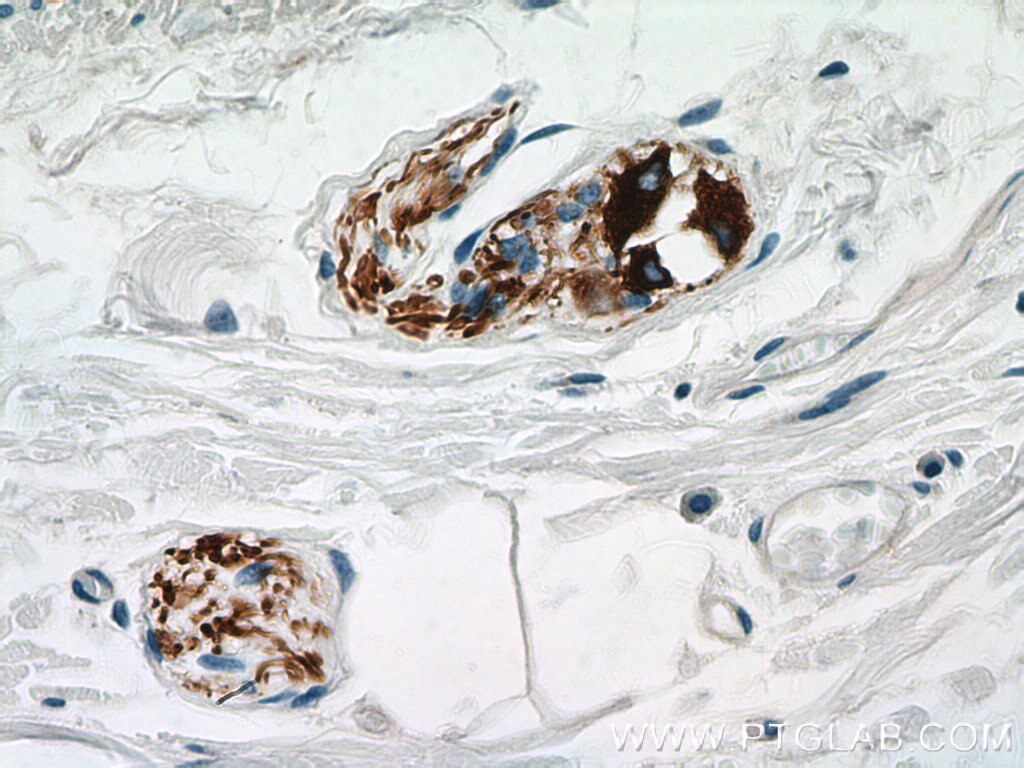 Immunohistochemistry (IHC) staining of human colon tissue using Peripherin Monoclonal antibody (66317-1-Ig)