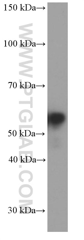 Western Blot (WB) analysis of rat brain tissue using Peripherin Monoclonal antibody (66317-1-Ig)