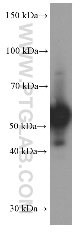 Western Blot (WB) analysis of rat colon tissue using Peripherin Monoclonal antibody (66317-1-Ig)