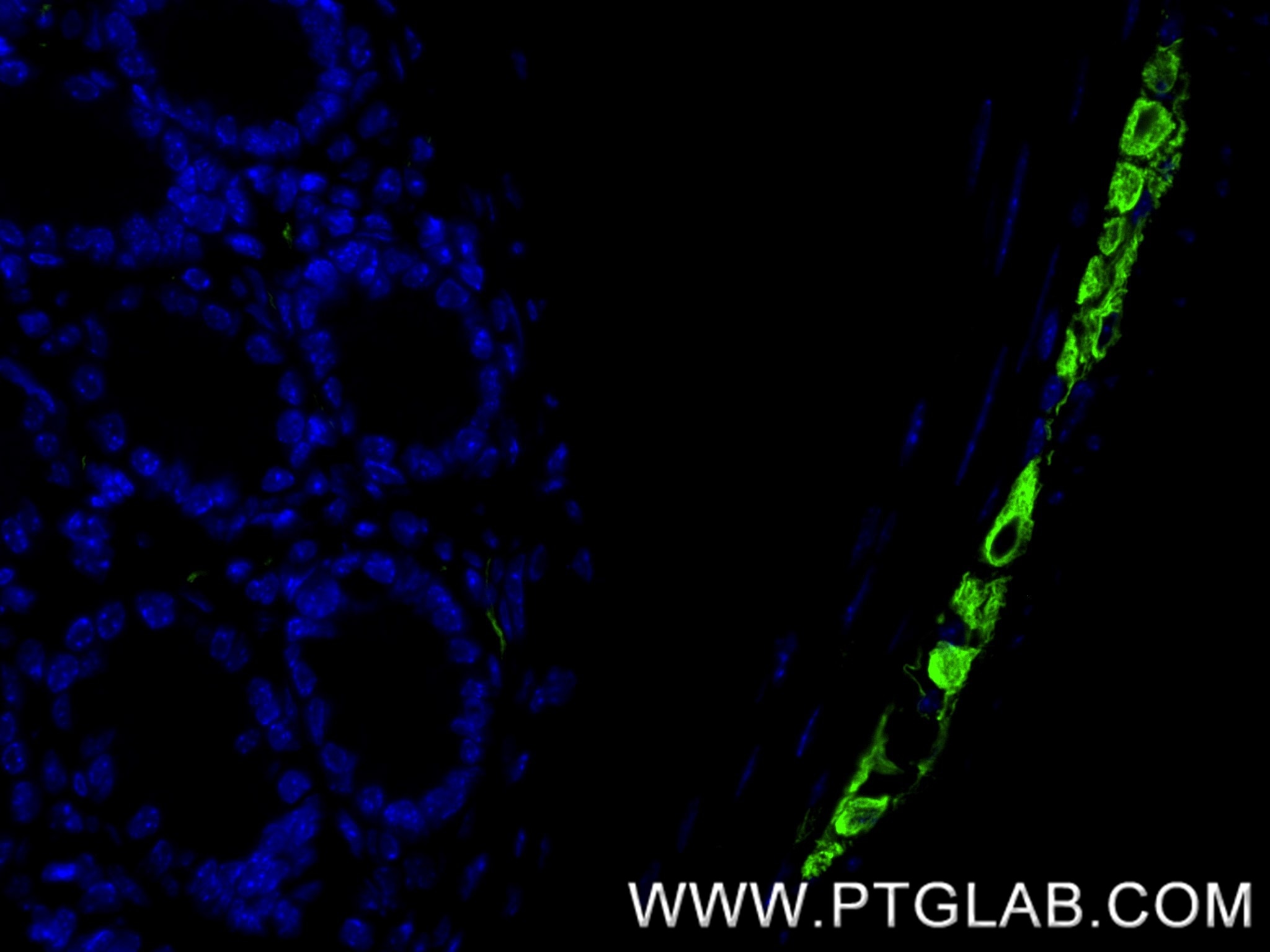 Immunofluorescence (IF) / fluorescent staining of mouse colon tissue using Peripherin Recombinant antibody (86057-1-RR)