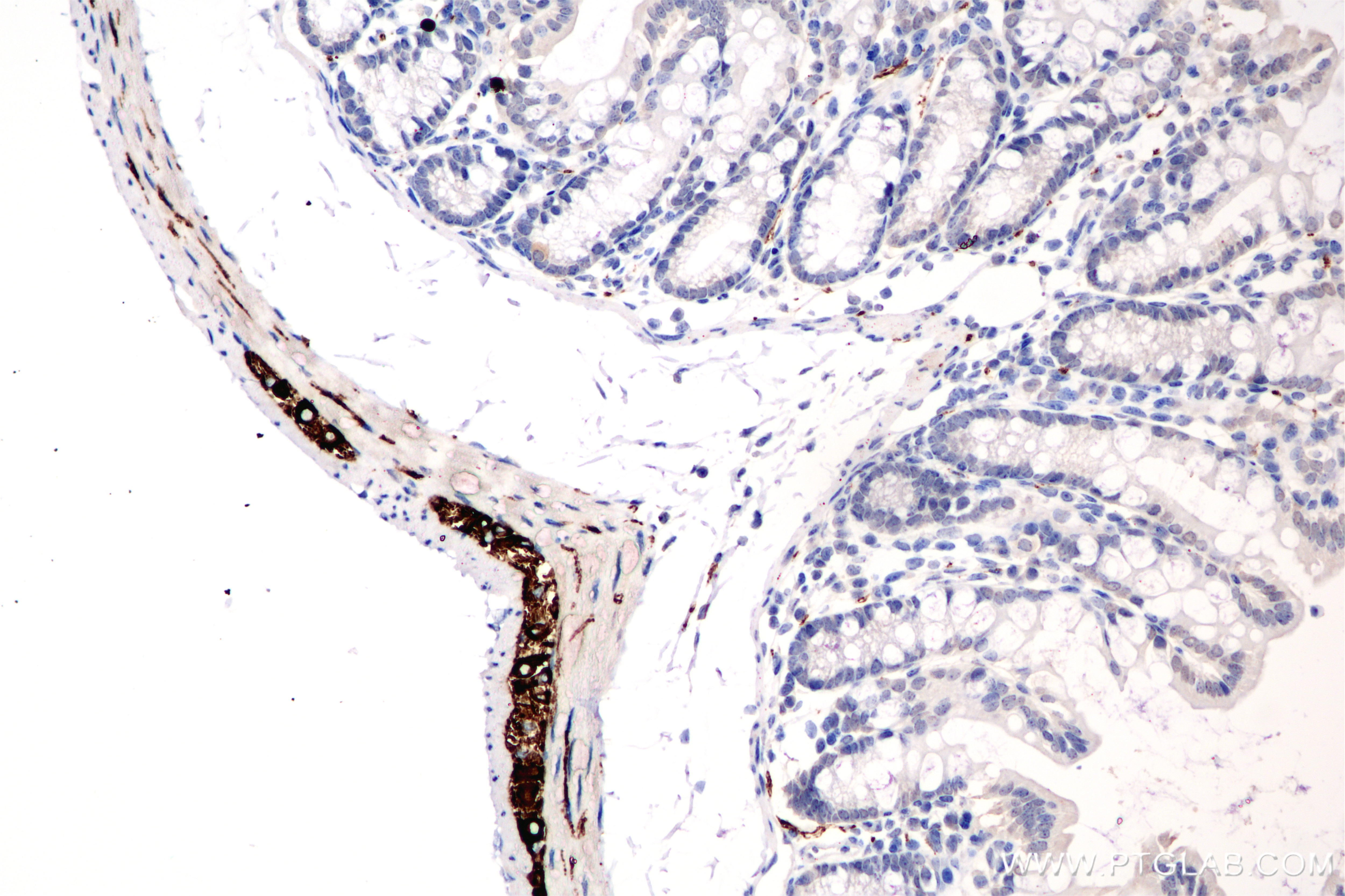 Immunohistochemistry (IHC) staining of mouse colon tissue using Peripherin Recombinant antibody (86057-1-RR)