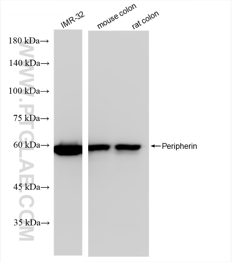 Western Blot (WB) analysis of various lysates using Peripherin Recombinant antibody (86057-1-RR)