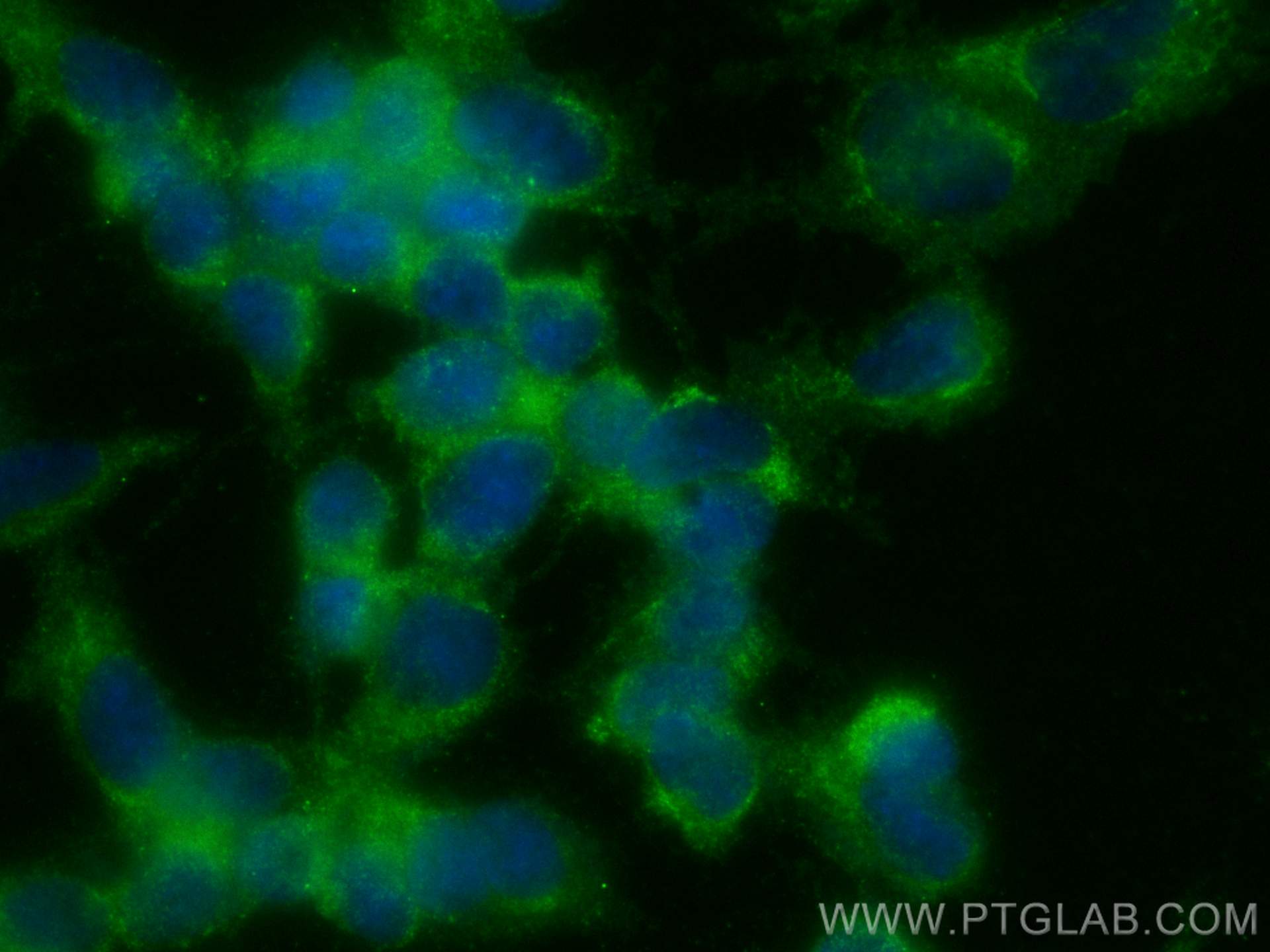 Immunofluorescence (IF) / fluorescent staining of SH-SY5Y cells using CoraLite® Plus 488-conjugated Peripherin Monoclona (CL488-66317)