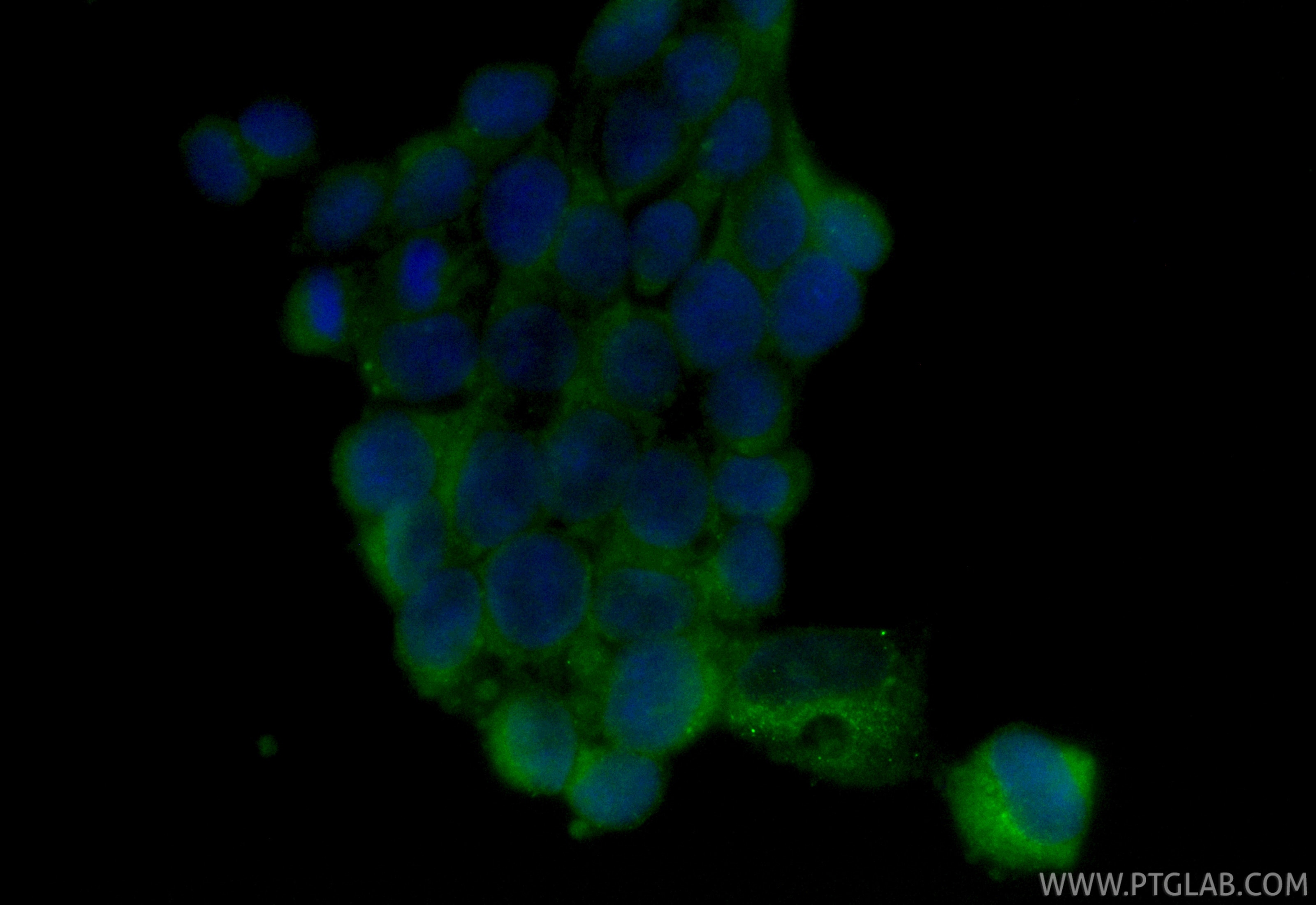 Immunofluorescent analysis of (-20°C Ethanol) fixed SH-SY5Y cells using CoraLite® Plus 488 Peripherin antibody (CL488-86057, Clone: 250661A3 ) at dilution of 1:200. Immunofluorescence (IF) / fluorescent staining of SH-SY5Y cells using CoraLite® Plus 488-conjugated Peripherin Recombina (CL488-86057)