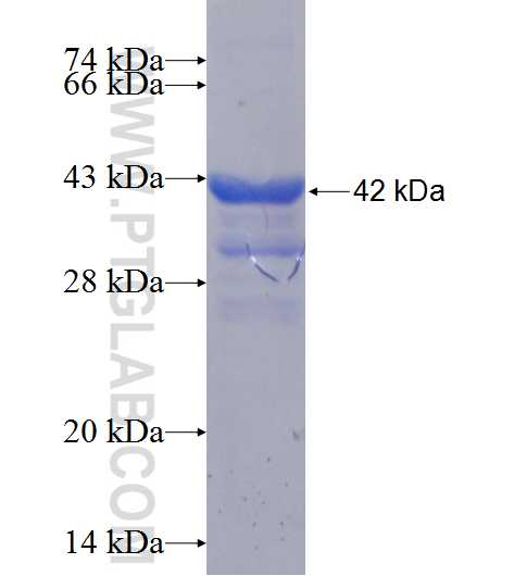 Peripherin fusion protein Ag11116 SDS-PAGE