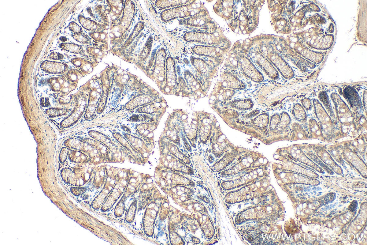 Immunohistochemistry (IHC) staining of mouse colon tissue using Periphilin 1 Polyclonal antibody (30437-1-AP)