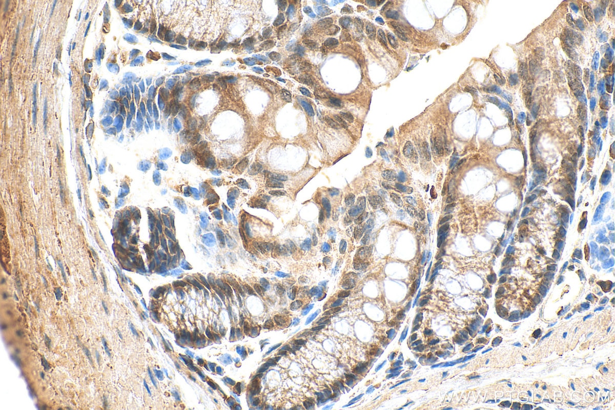 Immunohistochemistry (IHC) staining of mouse colon tissue using Periphilin 1 Polyclonal antibody (30437-1-AP)