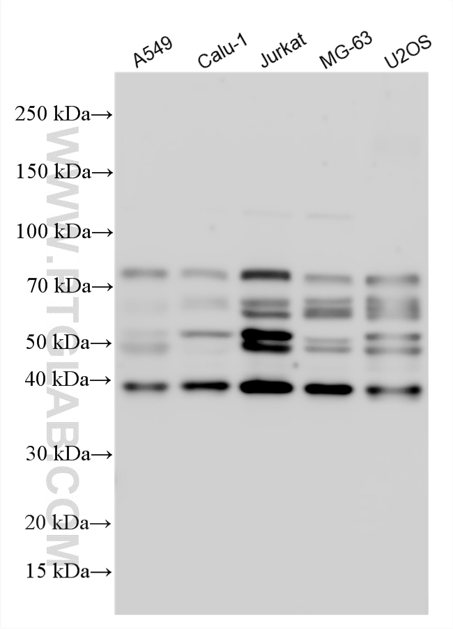 Western Blot (WB) analysis of various lysates using Periphilin 1 Polyclonal antibody (30437-1-AP)