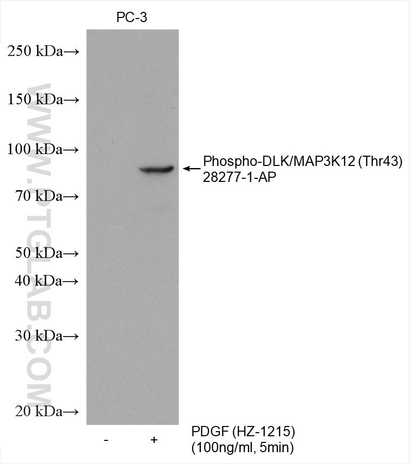 Western Blot (WB) analysis of various lysates using Phospho-DLK/MAP3K12 (Thr43) Polyclonal antibody (28277-1-AP)
