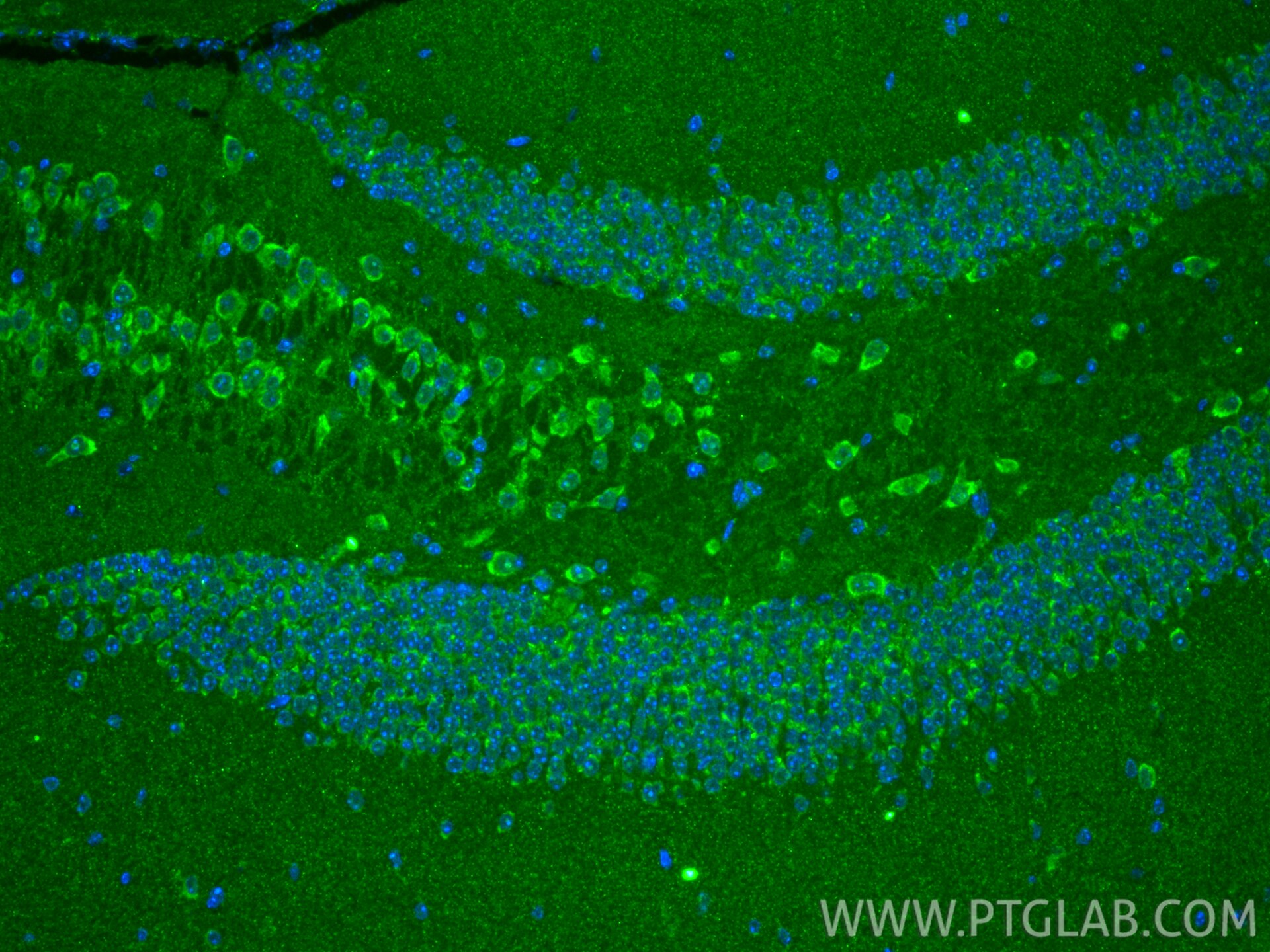 IF Staining of mouse brain using 29119-1-AP Immunofluorescence (IF) / fluorescent staining of mouse brain tissue using Phospho-ACC1 (Ser79) Polyclonal antibody (29119-1-AP)