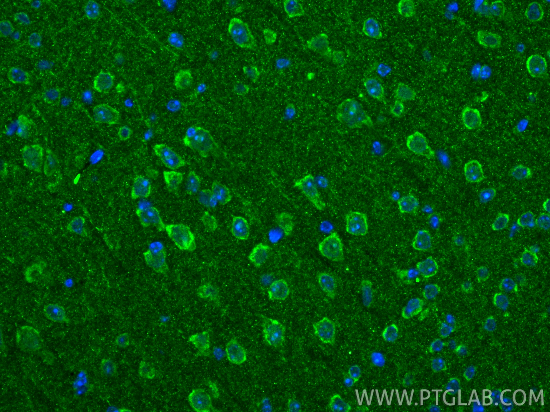 IF Staining of mouse brain using 29119-1-AP Immunofluorescence (IF) / fluorescent staining of mouse brain tissue using Phospho-ACC1 (Ser79) Polyclonal antibody (29119-1-AP)