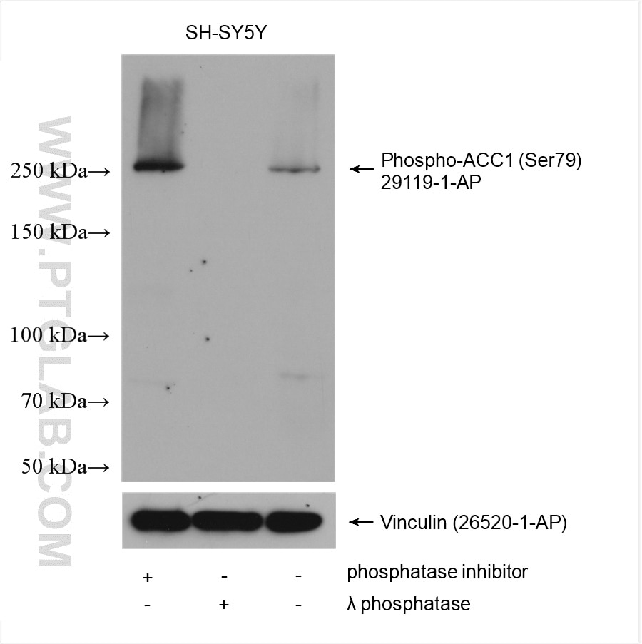 Western Blot (WB) analysis of various lysates using Phospho-ACC1 (Ser79) Polyclonal antibody (29119-1-AP)