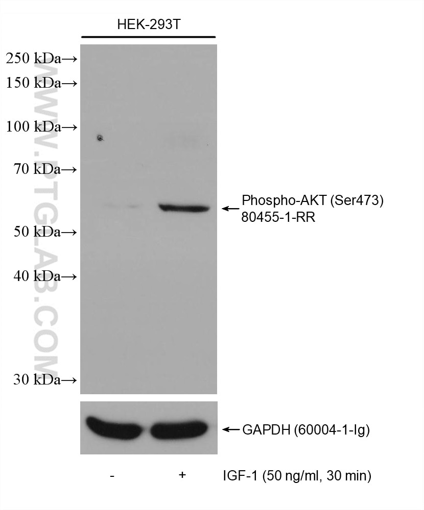 Western Blot (WB) analysis of HEK-293T cells using Phospho-AKT (Ser473) Recombinant antibody (80455-1-RR)