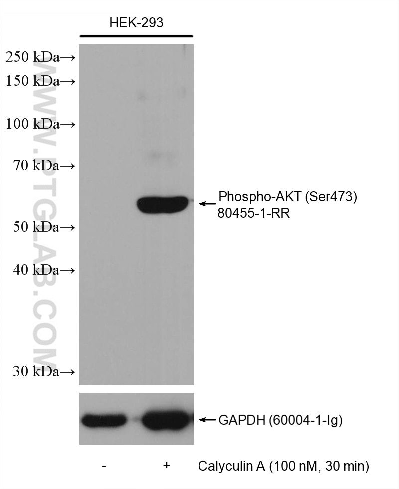 Western Blot (WB) analysis of HEK-293 cells using Phospho-AKT (Ser473) Recombinant antibody (80455-1-RR)