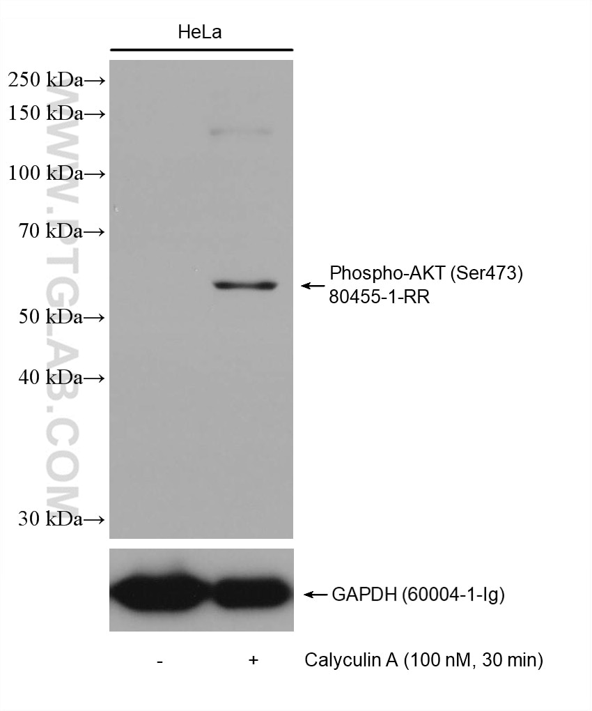 Western Blot (WB) analysis of HeLa cells using Phospho-AKT (Ser473) Recombinant antibody (80455-1-RR)