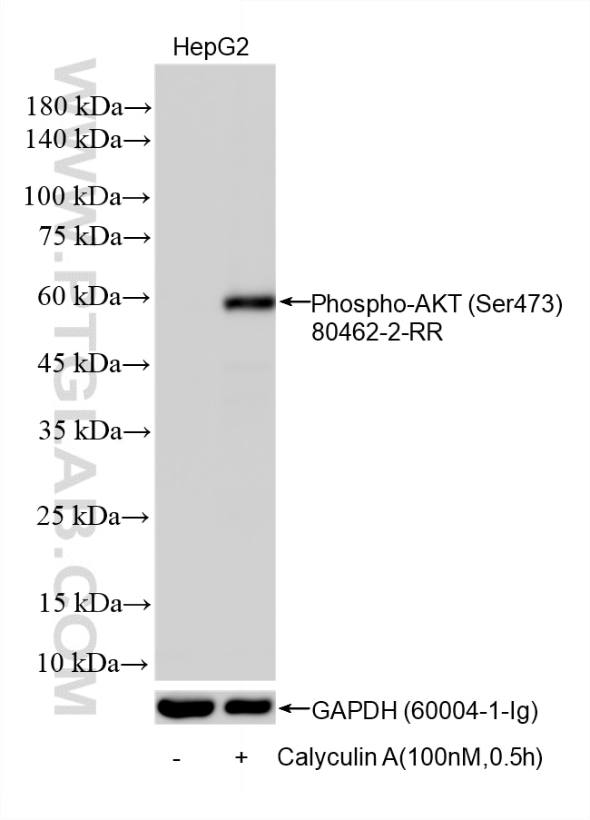 WB analysis using 80462-2-RR Western Blot (WB) analysis of various lysates using Phospho-AKT (Ser473) Recombinant monoclonal antibo (80462-2-RR)