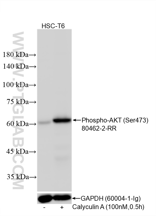 WB analysis using 80462-2-RR Western Blot (WB) analysis of various lysates using Phospho-AKT (Ser473) Recombinant monoclonal antibo (80462-2-RR)