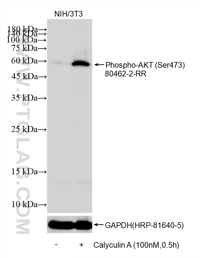WB analysis using 80462-2-RR Western Blot (WB) analysis of various lysates using Phospho-AKT (Ser473) Recombinant monoclonal antibo (80462-2-RR)