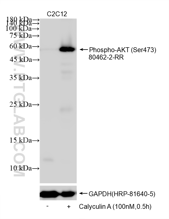 WB analysis using 80462-2-RR Western Blot (WB) analysis of various lysates using Phospho-AKT (Ser473) Recombinant monoclonal antibo (80462-2-RR)